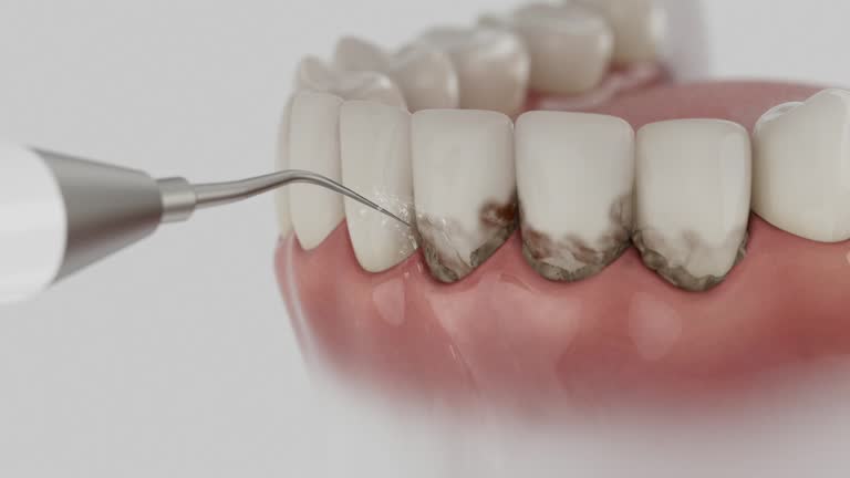 Reliable Dental Implants contractor in Scotchtown, NY by Smile Center Dentistry